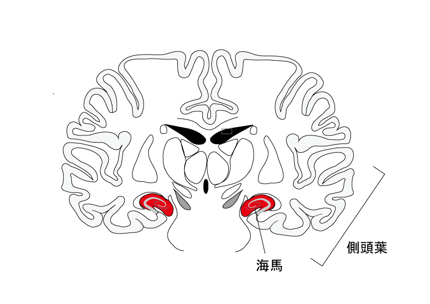 図１　海馬の位置、海馬は側頭葉の内側に存在します